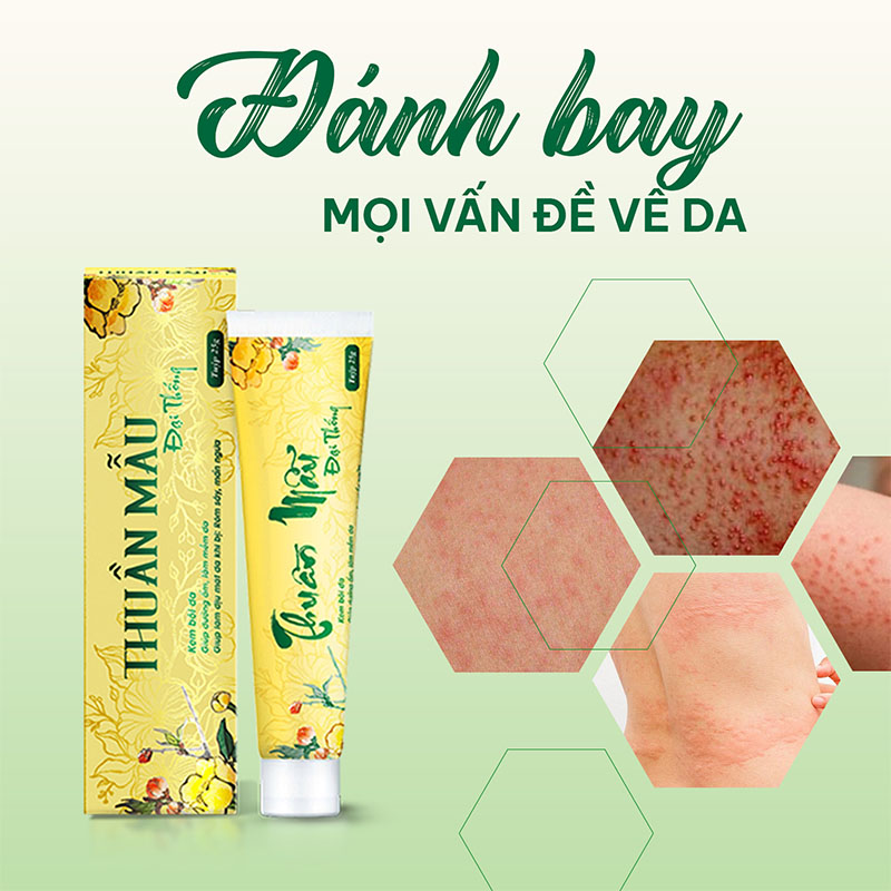Đánh bay mọi vấn đề về da-kem bôi da thuần mẫu đại thống